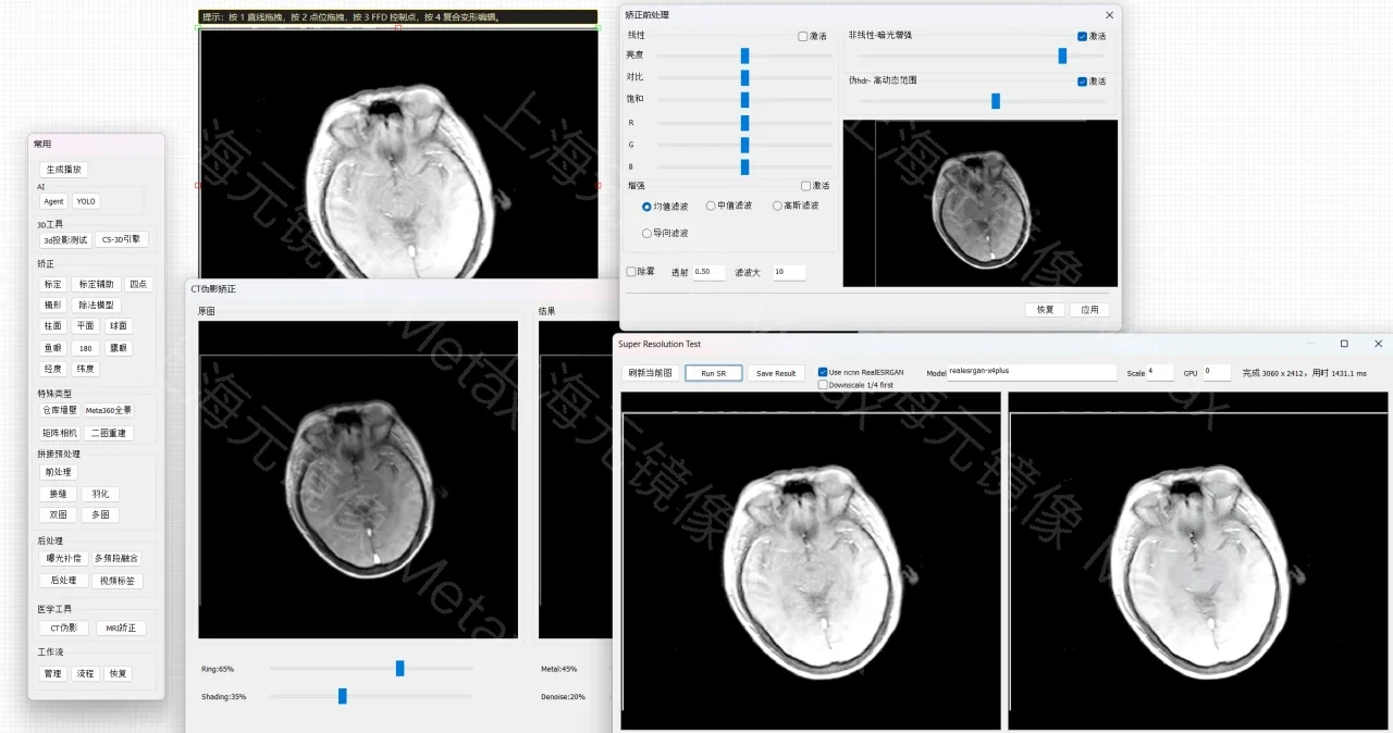 Medical Imaging Correction — complete correction pipeline